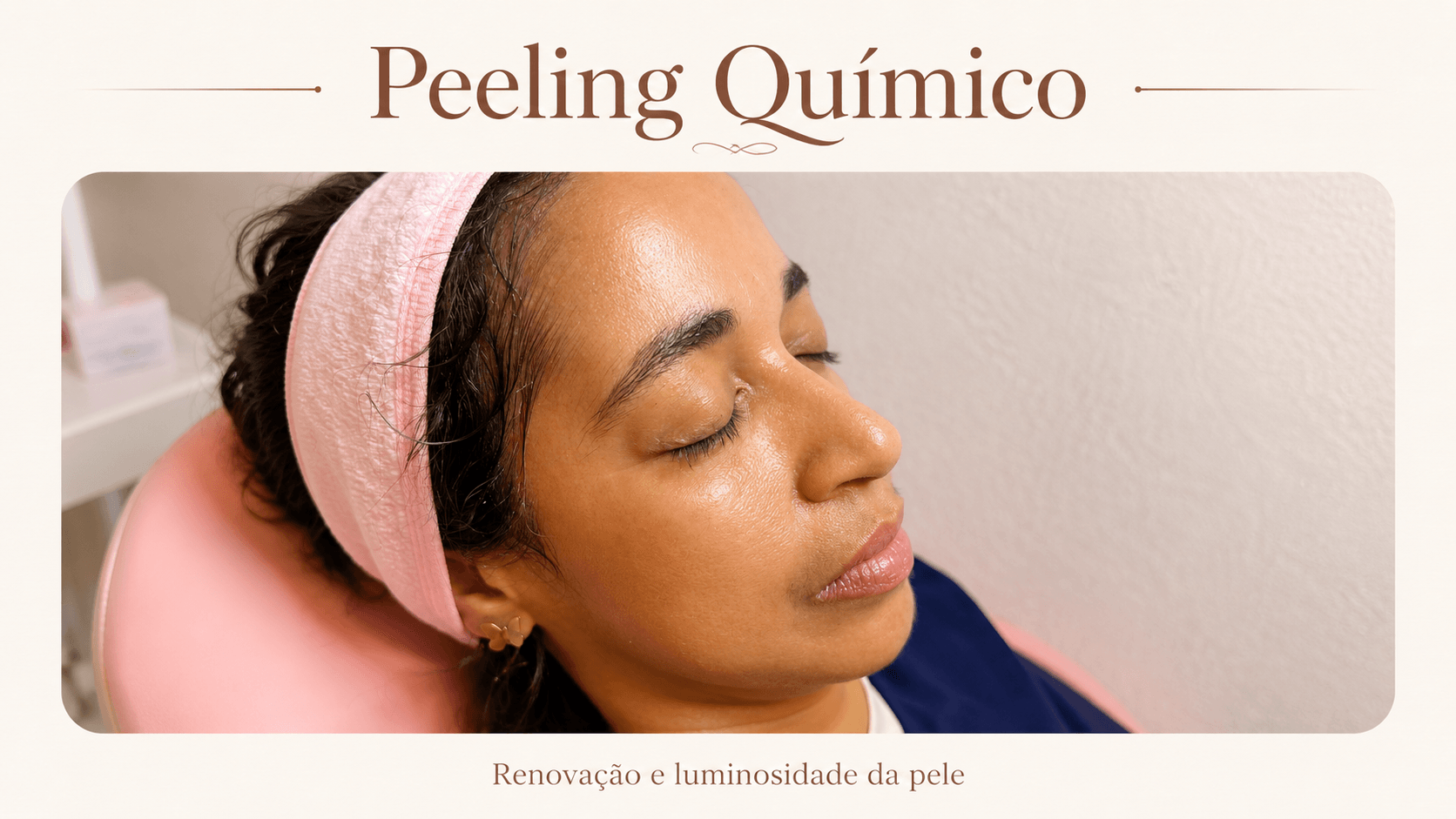 Ilustração de peeling químico e renovação da pele